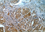 RBM16 Antibody in Immunohistochemistry (Paraffin) (IHC (P))