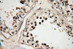 RBM16 Antibody in Immunohistochemistry (Paraffin) (IHC (P))