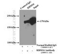 RBM16 Antibody in Immunoprecipitation (IP)