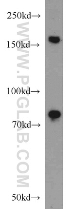 RBM16 Antibody in Western Blot (WB)