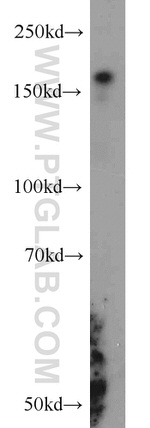 RBM16 Antibody in Western Blot (WB)