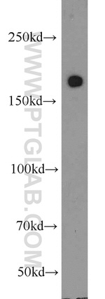 RBM16 Antibody in Western Blot (WB)