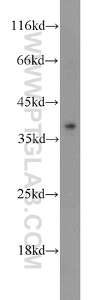 ADH1C Antibody in Western Blot (WB)