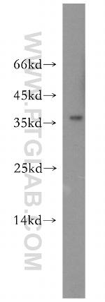 ADH1C Antibody in Western Blot (WB)