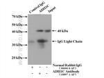 ADH1C Antibody in Western Blot (WB)