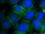 ZO-2 Antibody in Immunocytochemistry (ICC/IF)