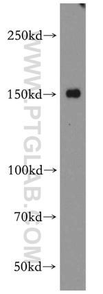 ZO-2 Antibody in Western Blot (WB)