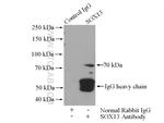 SOX13 Antibody in Immunoprecipitation (IP)