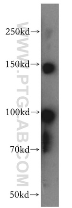 SOX13 Antibody in Western Blot (WB)