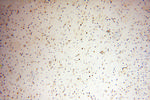 NDC80 Antibody in Immunohistochemistry (Paraffin) (IHC (P))