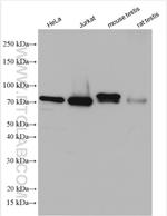 NDC80 Antibody in Western Blot (WB)