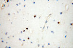 NDC80 Antibody in Immunohistochemistry (Paraffin) (IHC (P))