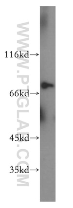 NDC80 Antibody in Western Blot (WB)