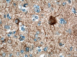 NF-H Antibody in Immunohistochemistry (Paraffin) (IHC (P))