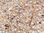 NF-H Antibody in Immunohistochemistry (Paraffin) (IHC (P))