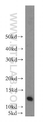 LSM7 Antibody in Western Blot (WB)