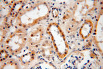 MYOD1 Antibody in Immunohistochemistry (Paraffin) (IHC (P))