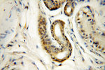 MYOD1 Antibody in Immunohistochemistry (Paraffin) (IHC (P))