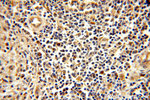MYOD1 Antibody in Immunohistochemistry (Paraffin) (IHC (P))