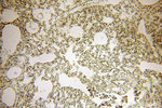 MYOD1 Antibody in Immunohistochemistry (Paraffin) (IHC (P))