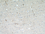 BBS7 Antibody in Immunohistochemistry (Paraffin) (IHC (P))