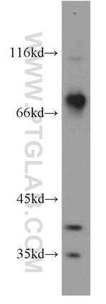 BBS7 Antibody in Western Blot (WB)