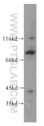 BBS7 Antibody in Western Blot (WB)