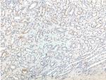 NKCC2 Antibody in Immunohistochemistry (Paraffin) (IHC (P))