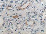 NKCC2 Antibody in Immunohistochemistry (Paraffin) (IHC (P))