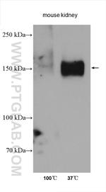 NKCC2 Antibody in Western Blot (WB)