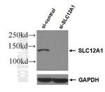 NKCC2 Antibody in Western Blot (WB)