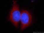 ZCCHC11 Antibody in Immunocytochemistry (ICC/IF)