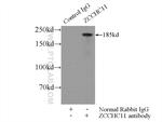 ZCCHC11 Antibody in Immunoprecipitation (IP)