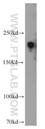 ZCCHC11 Antibody in Western Blot (WB)