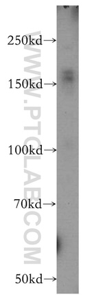 ZCCHC11 Antibody in Western Blot (WB)