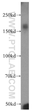 ZCCHC11 Antibody in Western Blot (WB)