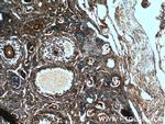 BMP15 Antibody in Immunohistochemistry (Paraffin) (IHC (P))