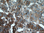 BMP15 Antibody in Immunohistochemistry (Paraffin) (IHC (P))