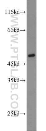 BMP15 Antibody in Western Blot (WB)