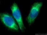 iNOS Antibody in Immunocytochemistry (ICC/IF)