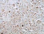 EGFR Antibody in Immunohistochemistry (Paraffin) (IHC (P))