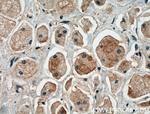 EGFR Antibody in Immunohistochemistry (Paraffin) (IHC (P))