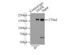 EGFR Antibody in Immunoprecipitation (IP)