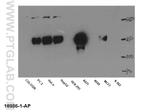 EGFR Antibody in Western Blot (WB)