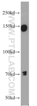 EGFR Antibody in Western Blot (WB)