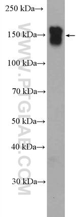 EGFR Antibody in Western Blot (WB)