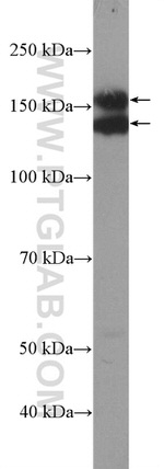 EGFR Antibody in Western Blot (WB)