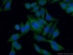 DOCK9 Antibody in Immunocytochemistry (ICC/IF)