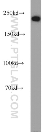 DOCK9 Antibody in Western Blot (WB)