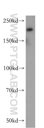 DOCK9 Antibody in Western Blot (WB)